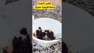 تقشير البشرة ?وصفة طبيعية مجربة وناجحة ??