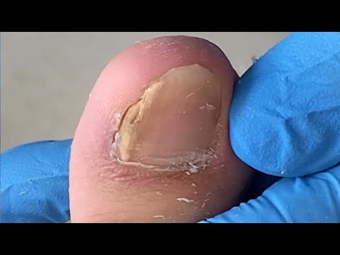 Wideo: Najmodniejszy pedicure 2018: nowości