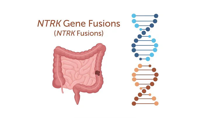Colorectal Cancer Biomarkers: NTRK Fusions