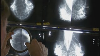 Here's when experts say you should get a mammogram