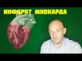 ИНФАРКТ МИОКАРДА