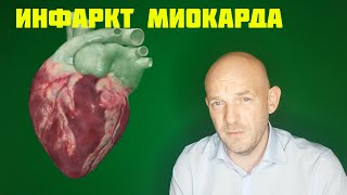 ИНФАРКТ МИОКАРДА