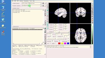 NeuroElf - defining ROIs