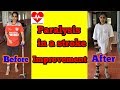 paralysis in a stroke improvement after exercises