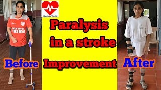 paralysis in a stroke improvement after exercises