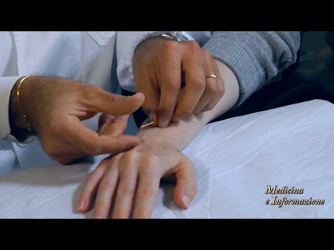 Video: Agopuntura Auricolare: Cosa Può Aiutare