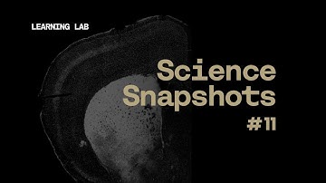 Science Snapshot: Circuits of Action and Suppression