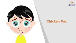 Chicken Pox: Symptoms, Causes, Prevention and Treatment Yashoda Hospitals