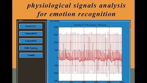 Hilbert-Huang transform based physiological signals analysis for emotion recognition Matlab Project