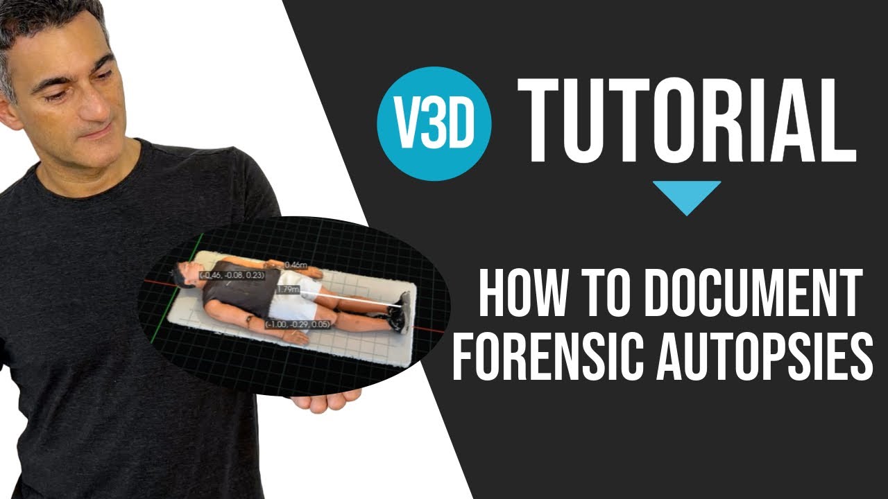TUTORIAL | How to Document Forensic Autopsies in Vision-3D - YouTube