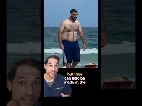 Fun fact: Abs