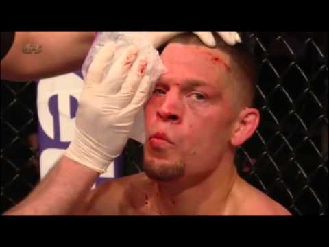 Conor McGregor vs nate diaz ufc 196