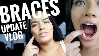 7 Month BRACES Update VLOG! | Let&#39;s go to Starbucks