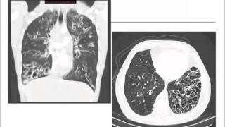 Clinical Immunology in Infectious Diseases - Vivian Vega, MD screenshot 5