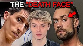 You Dont Want a Shredded Face
