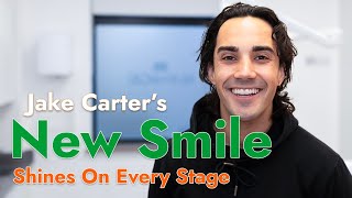 Jake Carters Smile Transformation Straight Teeth Confidence At 3Dental