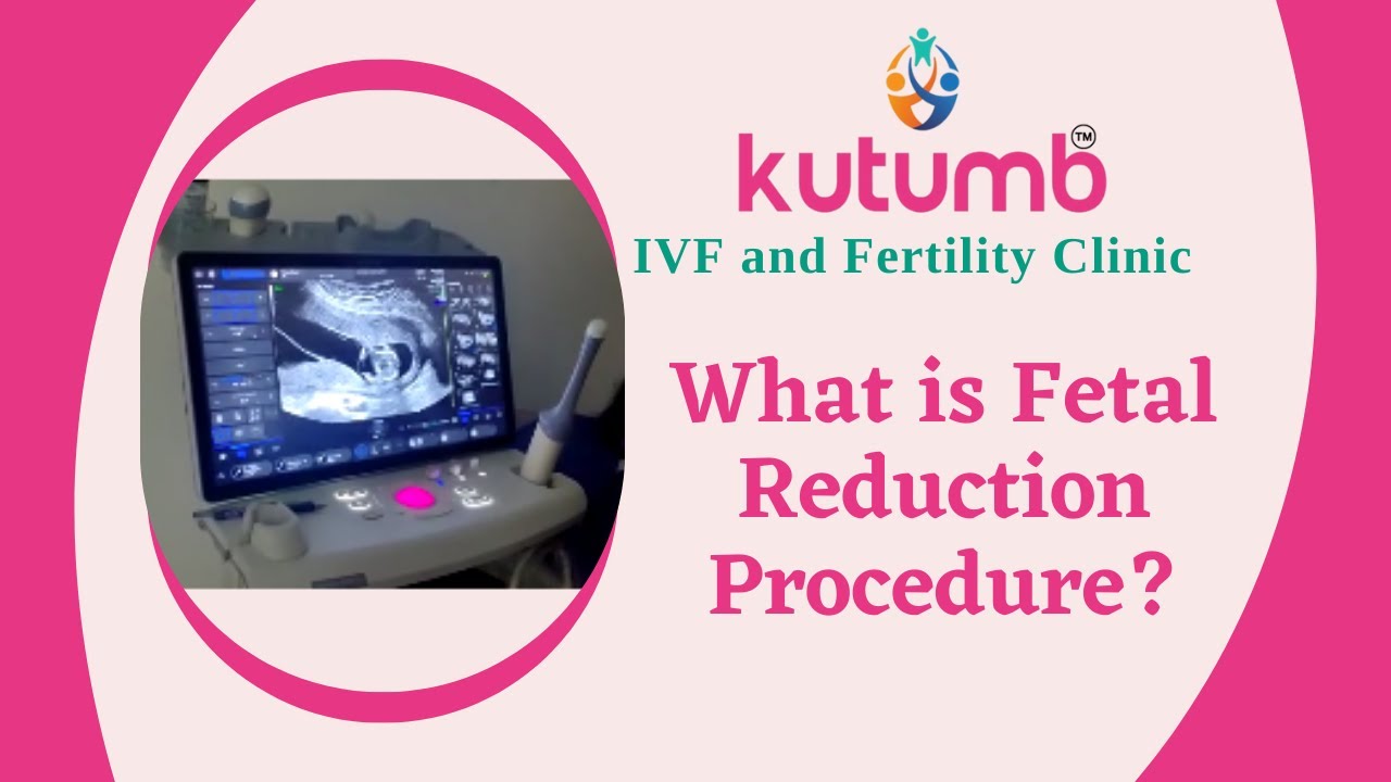 What Is Fetal Reduction Procedure Kutmb IVF And Fertility Clinic What Is Fetal Reduction Procedure Kutmb IVF And Fertility Clinic