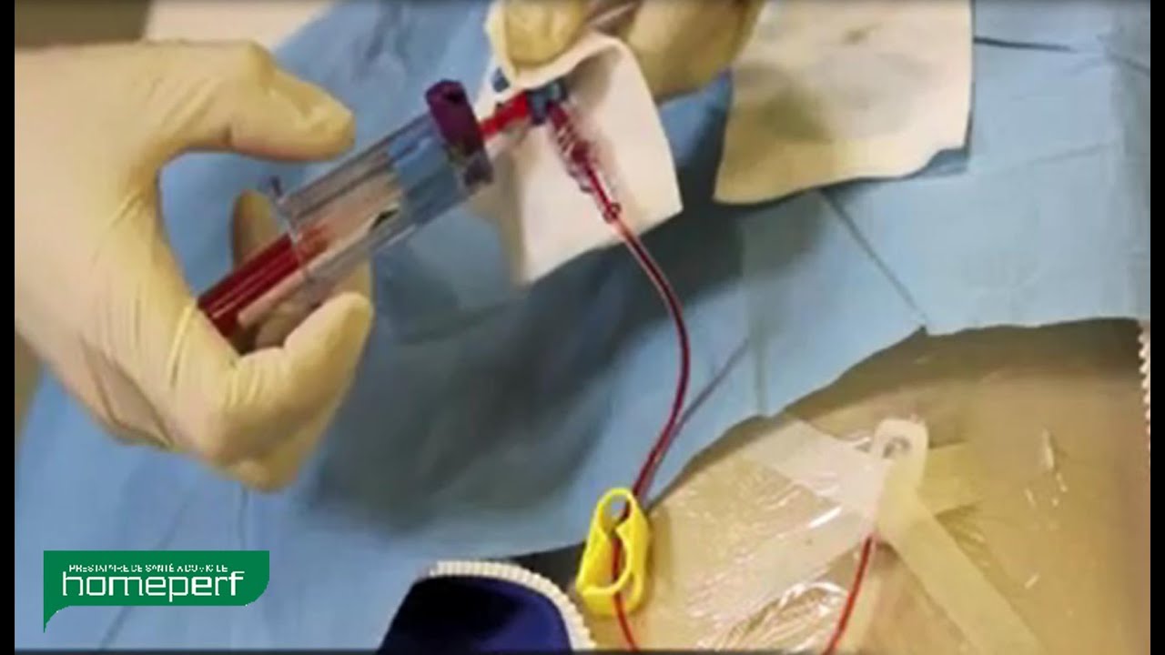 s8 prelevement sanguin sur chambre implantable