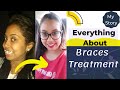 My Braces Journey || Life Changing Experience || Cost, Pain, Extraction || Braces treatment price