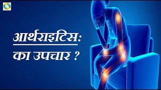 Arthritis ke Lakshan Aur Ilaj || Arthritis Treatment In Hindi || आर्थराइटिस का उपचार