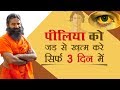 सिर्फ 3 दिन में करें पीलिया को जड़ से ख़त्म | Swami Ramdev