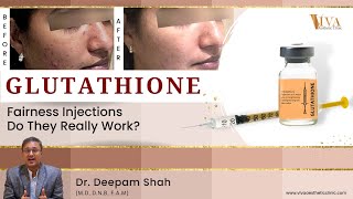 Glutathione Skin Whitening Injection | Glutathione Benefits Glutathione Skin Whitening Injection | Glutathione Benefits