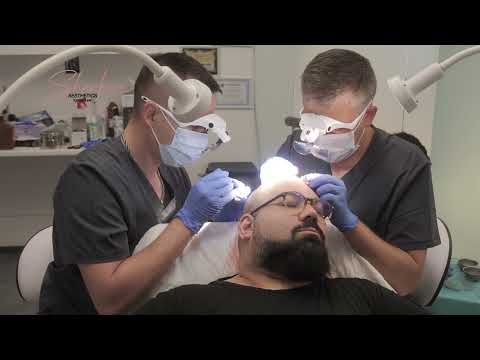 Видео: Принц Хари е забелязан в клиниката за трансплантация на коса