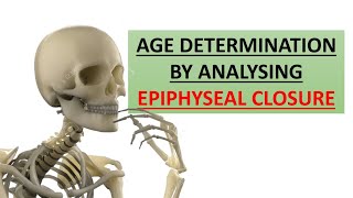 Age determination through epiphyseal closure of bones