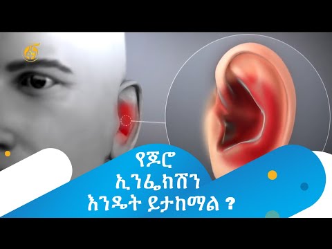 ቪዲዮ: የጆሮ ታምቡር እንዴት ይመስላል?