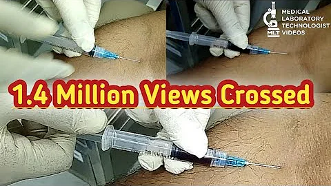 Safe and effective blood draw technique. How to take blood. phlebotomy