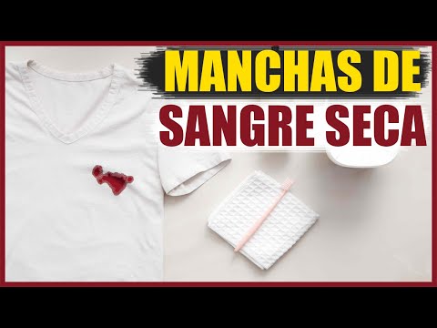 Cómo quitar manchas