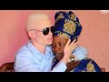 Albino's Love Story shocked the world : THIS VIDEO WILL MAKE YOU CRY