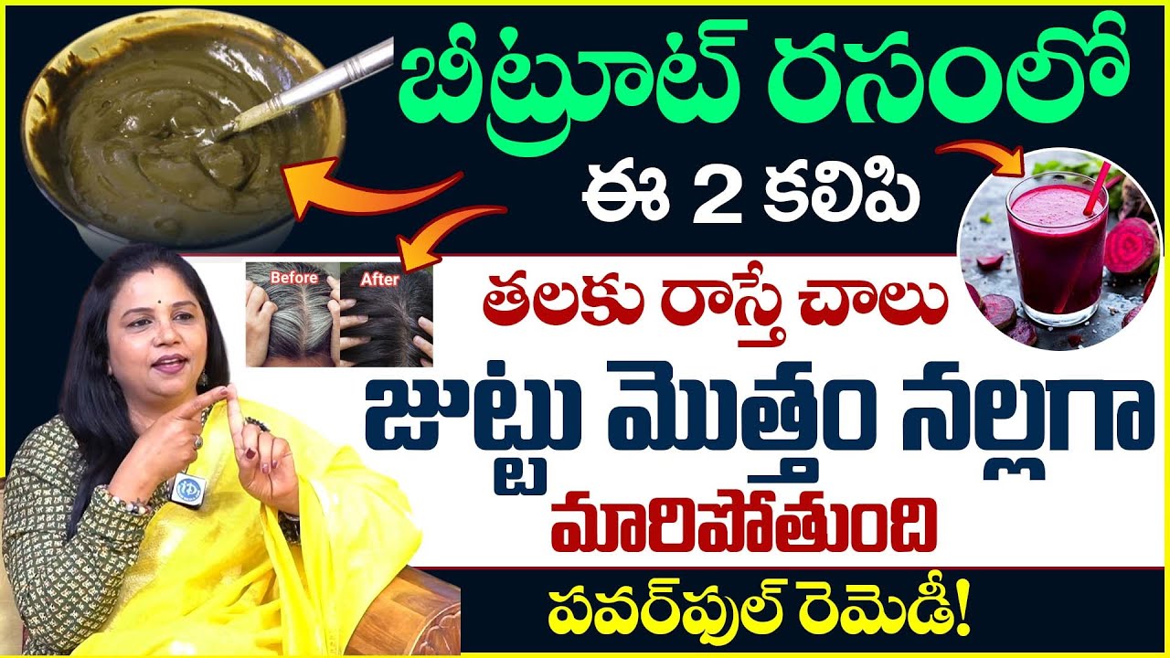 తెల్ల జుట్టు శాశ్వతంగా నల్లగా ఉండిపోతుంది|Grey Hair|Vanaja Ramisetty|iDream Health Plus 