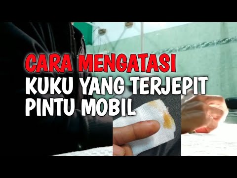 CARA MENGATASI DAN MENGOBATI KUKU YANG TERJEPIT PINTU MOBIL 