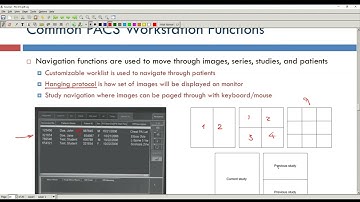 Picture Archiving and Comm System (PACS) (Part 2) - Med Informatics Course Recordings - Spring 2021