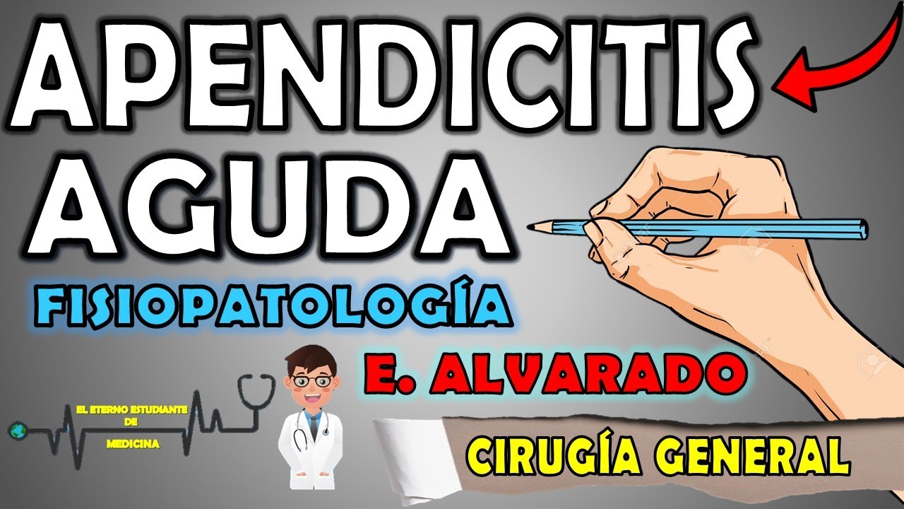 APENDICITIS AGUDA📝:Fisiopatología, Signos,Síntomas y Tratamiento|ESCALA DE ALVARADO Interpretación