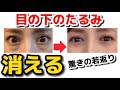 目の下のたるみを解消する方法【根本から改善】40代50代