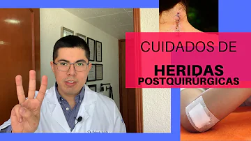 ¿Puede ducharse después de que le hayan quitado los puntos?