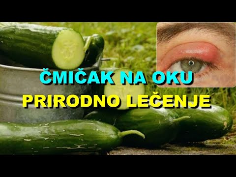 ČMIČAK Na OKU - PRIRODNO LEČENJE