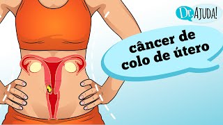 Quais Os Sintomas Do Câncer De Colo De Útero?