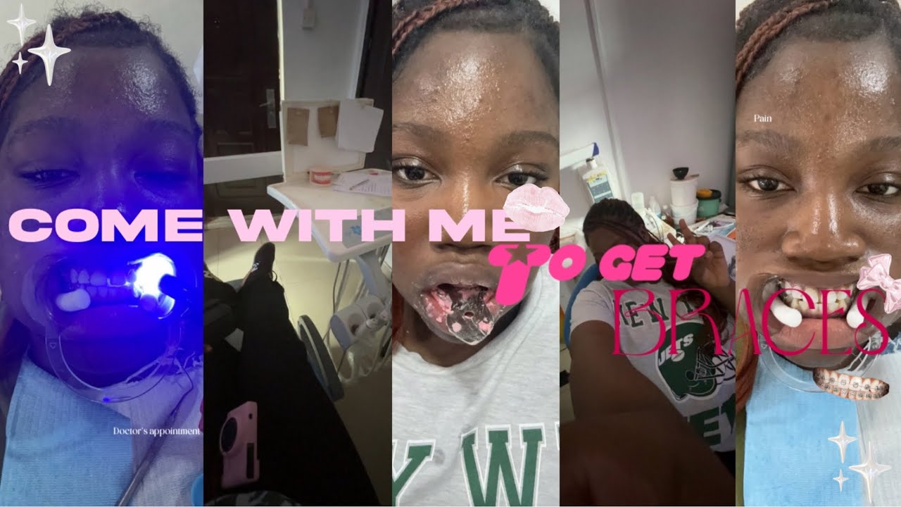 COME WITH ME TO GET BRACES |  doctor’s appointment, experience, pain level etc