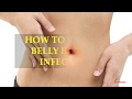 How to treat a belly button infection