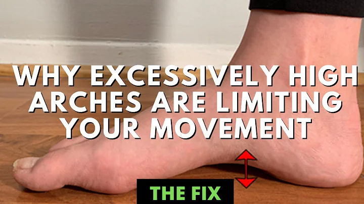 How High Foot Arches Can Limit Your Movement - The...