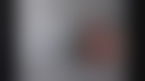 Right hepatectomy- Laparoscopy; Nicholas O