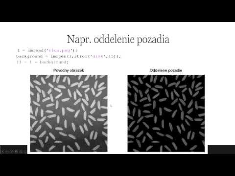 Náhľad videa: Watershed a šedotónová morfológia