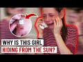 The Girl Allergic To Sunlight