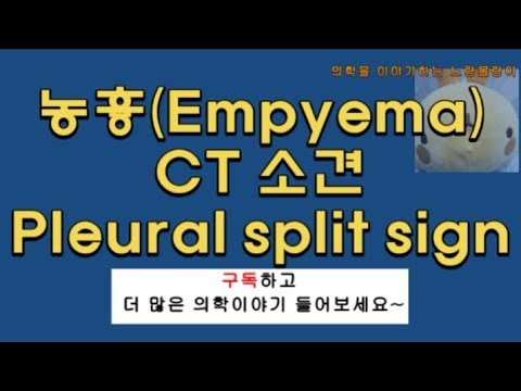 농흉(empyema)과 폐농양(lung abscess) 감별: CT 소견, split pleural sign