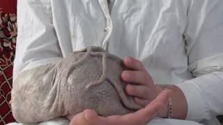 Deve Kuşu Yumurtasına İnsan Spermi Enjekte Edilirse HD Deve Kuşu Yumurtasına İnsan Spermi Enjekte Edilirse HD
