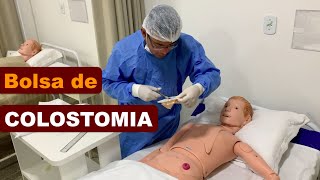 Colostomia