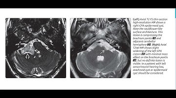 Brain Diagnostic imaging series book images (2)